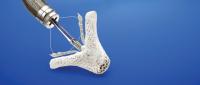 Close-up of a mitral valve repair device against a blue background.